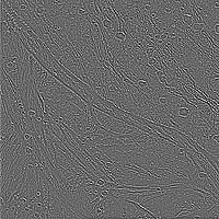 Output image showing results of the highpass application with 7 by 7 pixel filter.